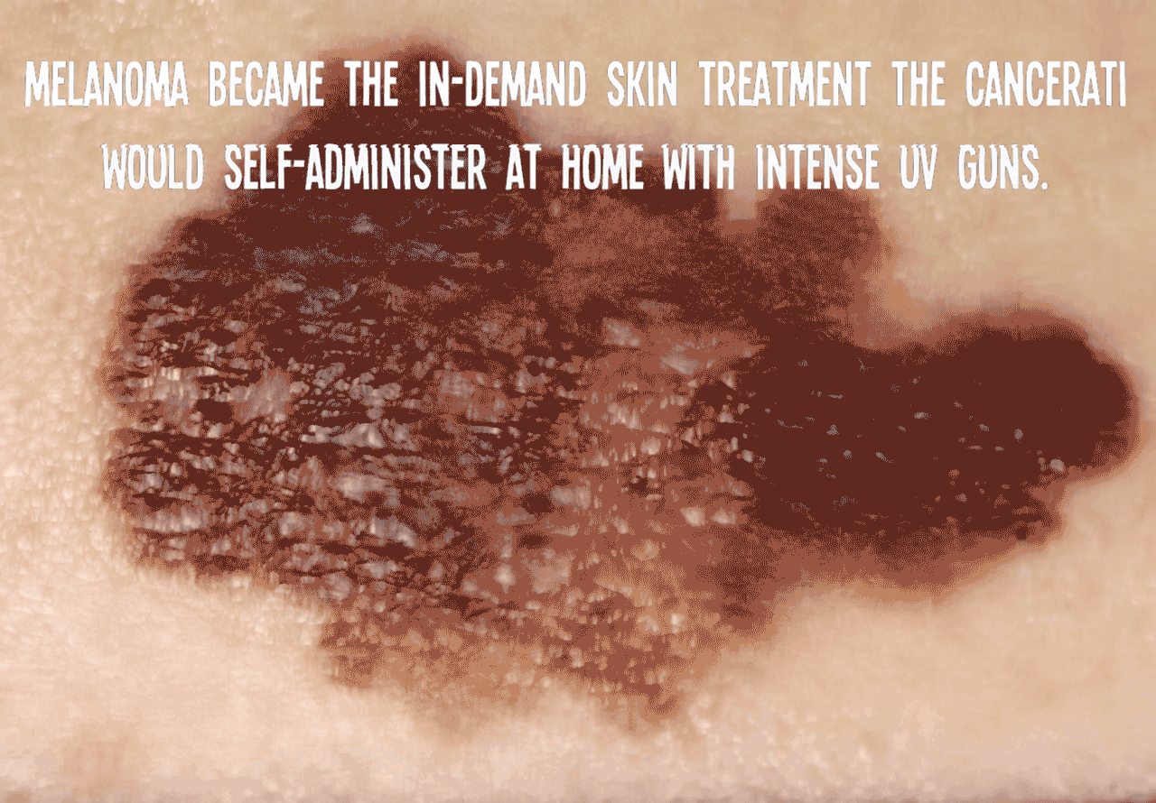 Melanoma became the in-demand skin treatment the cancerati would self-administer at home with intense UV guns.